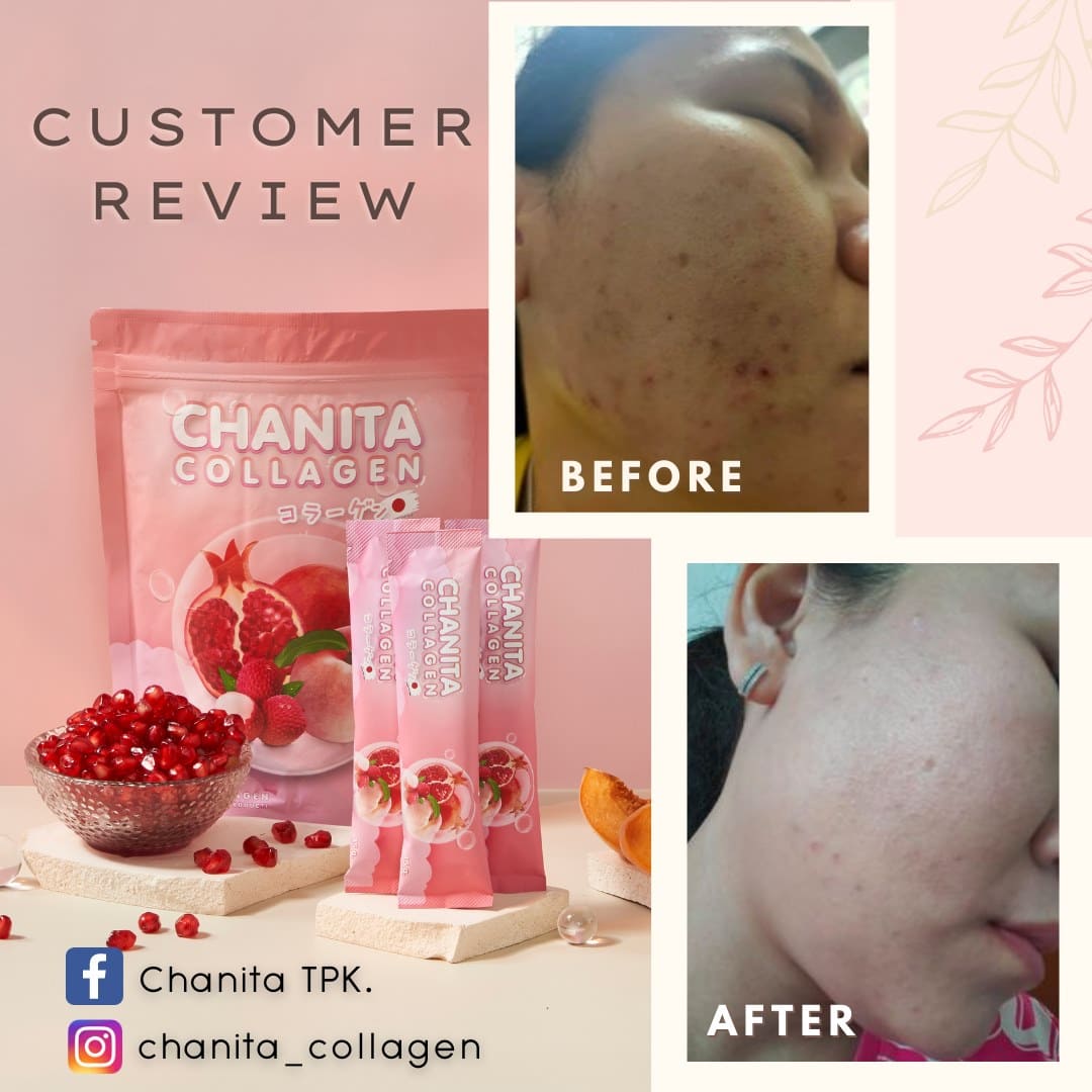 review-collagen-02